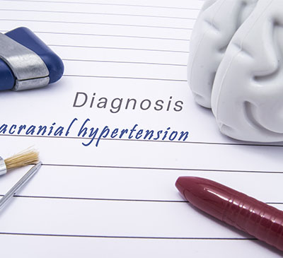 Idiopathic Intracranial Hypertension Therapeutics Market by Product and Geography - Forecast and Analysis 2019-2023